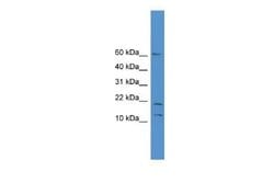SNAPC5 Rabbit anti-Human, Polyclonal, Novus Biologicals:Antibodies:Primary
